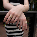 A person with dark nail polish and gold jewelry, including the Nimbus 4 Band Diamond Ring by SPINELLI KILCOLLIN, rests their hands on a railing while wearing a black and white striped dress.