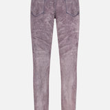 Skinny Flock Dipped Jeans (14706357338475)